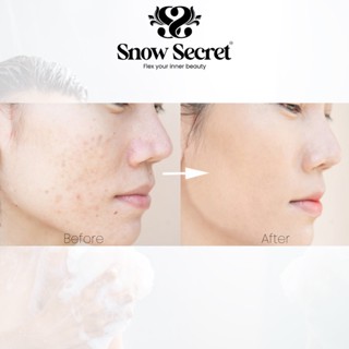SNOW SECRET NIACINAMIDE SOAP | 135G #4