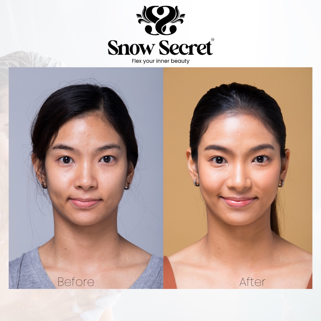 SNOW SECRET NIACINAMIDE SOAP | 135G