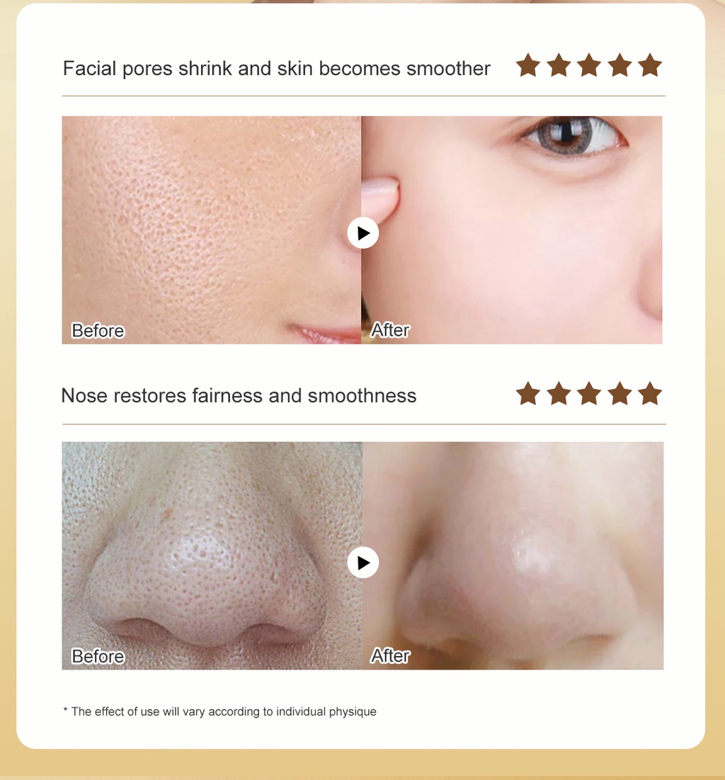 OEDO Shrink Pores Serum Hyaluronic Acid liquid Moisturizing Face Serum