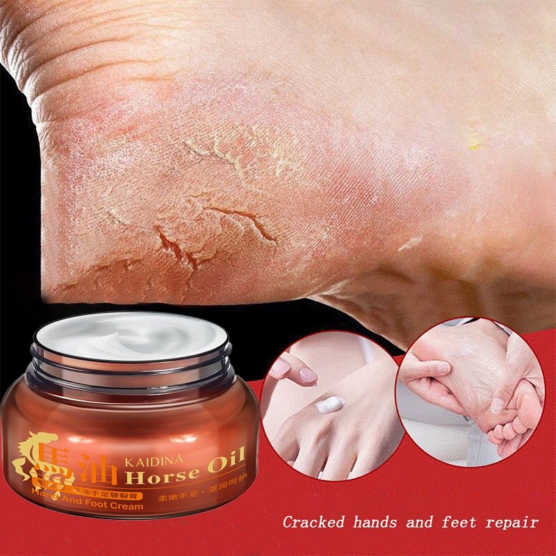 ,,250g Horse Oil Foot Cream For Cracks And Dry Cracked Heel Cream Remove Dead Skin