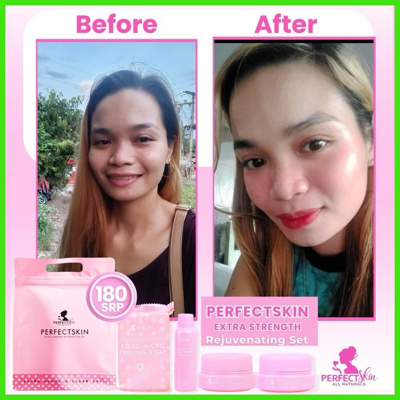 Authentic Perfect Skin Extra Strength Rejuvenating Set REVAMP